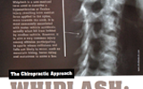 Whiplash: A Minor Injury with Major Symptoms Whiplash: A Minor Injury with Major Symptoms