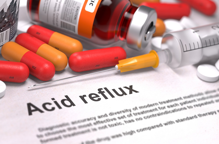 Avoiding acid reflux