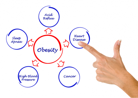 Most causes linked to acid reflux stem from consuming certain food and drinks, but it can also be due to obesity.