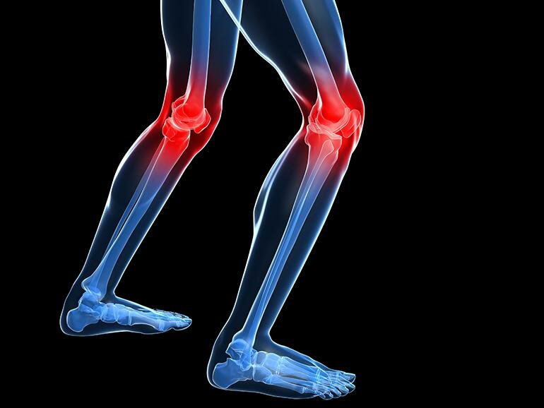Common sports injuries Common sports injuries